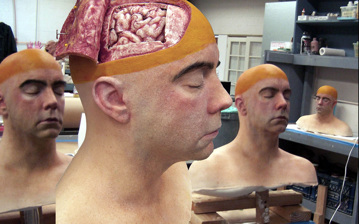 Brain removal on Dave Mathews for the series 'House M.D'