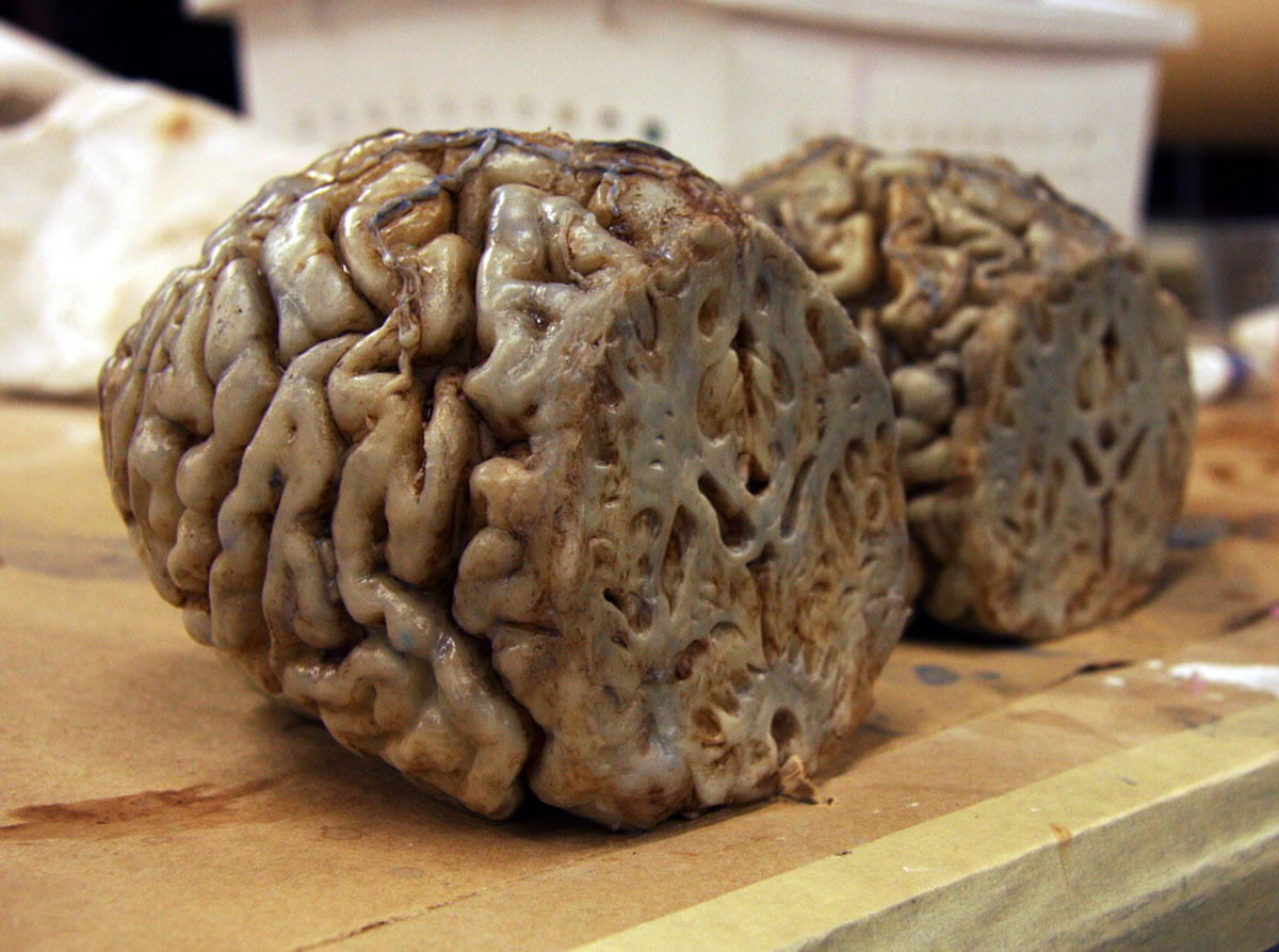 Dead brain for on camera slicing for the series 'Body of Proof'