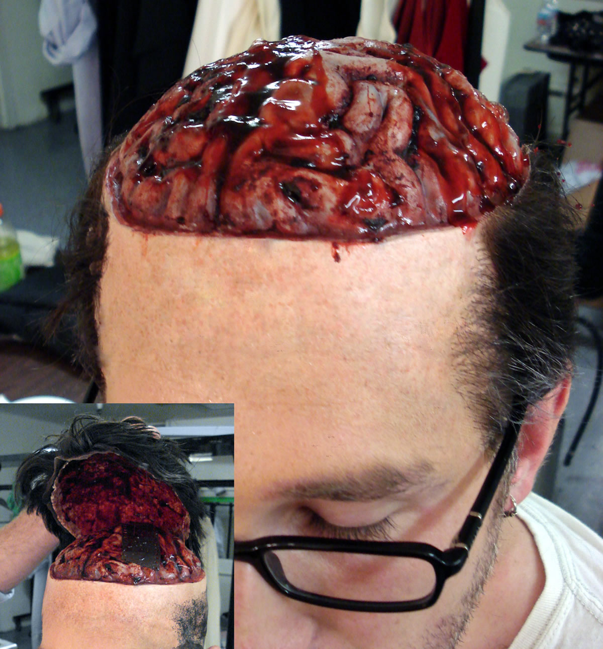Removable skull cap for exposed brain for the show 'Scream Awards'